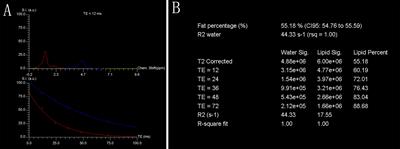 Associations Between Vertebral Marrow Proton Density Fat Fraction and Risk of Prostate Cancer